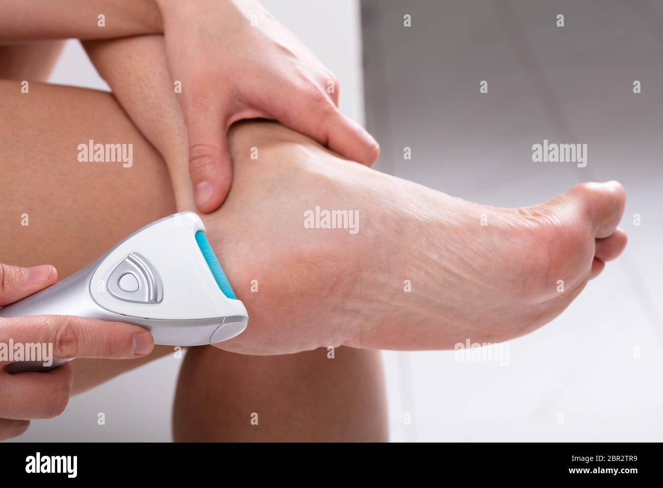 Care and cleansing of the woman feet from rough, flaky skin. An electric foot  dead skin remover in a woman's hand grinds foot heel at home Stock Photo -  Alamy