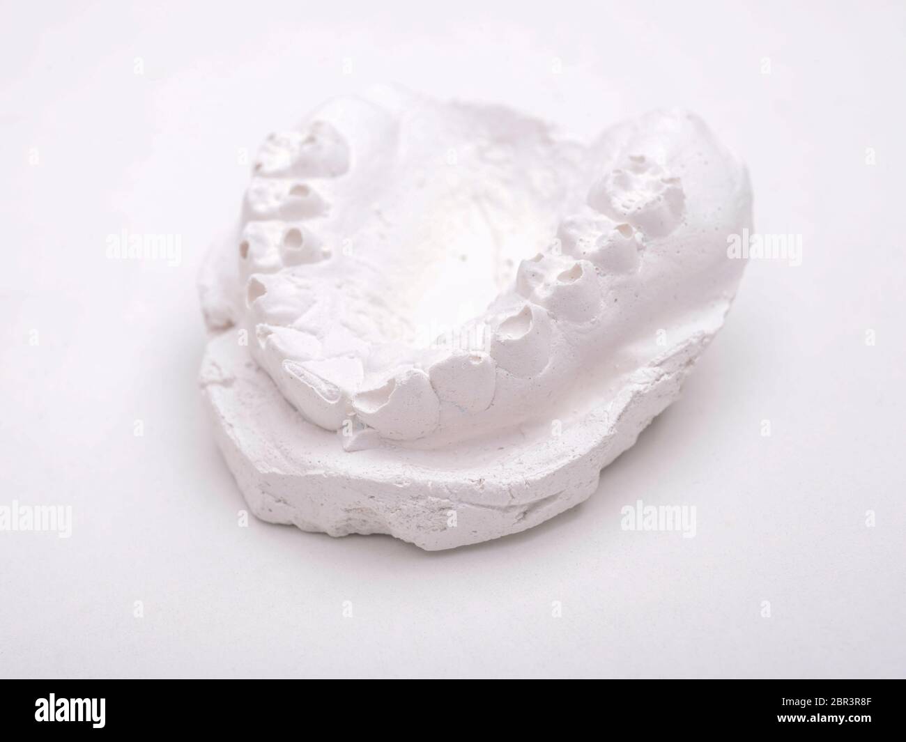 dentist gypsum impression of human jaw isolated on white background
