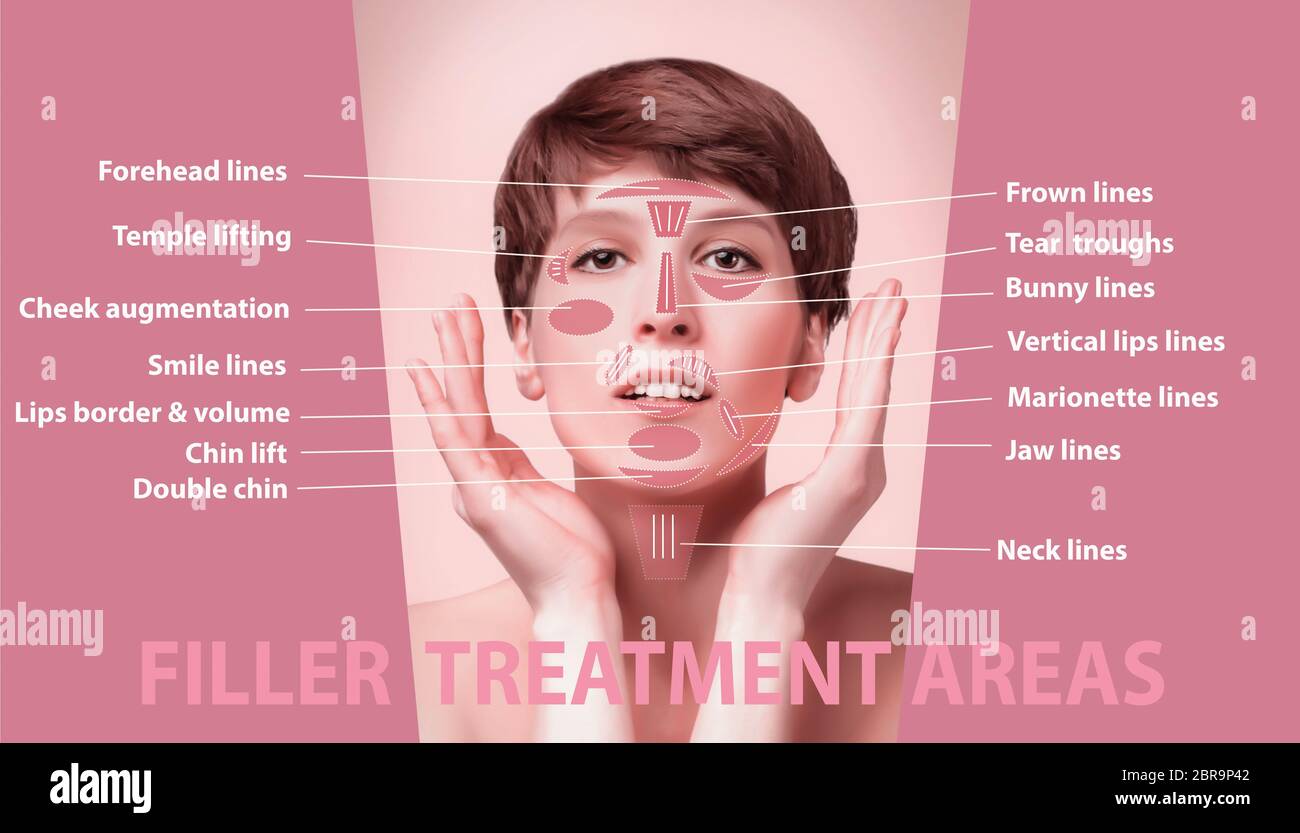 Female face and areas for rejuvenation cosmetological injections Stock ...