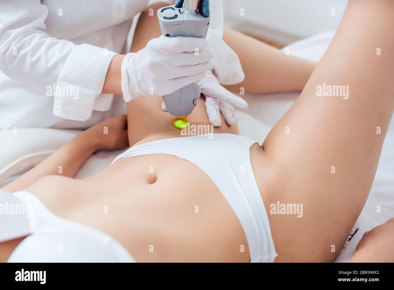 Hair removal in bikini zone using a laser device on young woman in cosmetic treatment Stock Photo