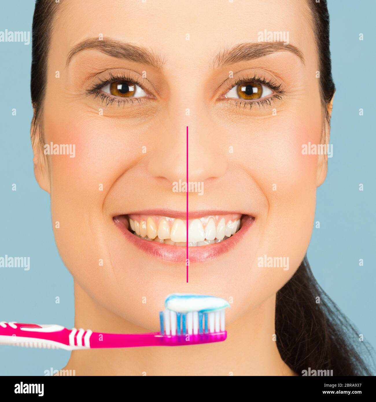 Healthy white teeth of smiling woman before and after brushing teeth