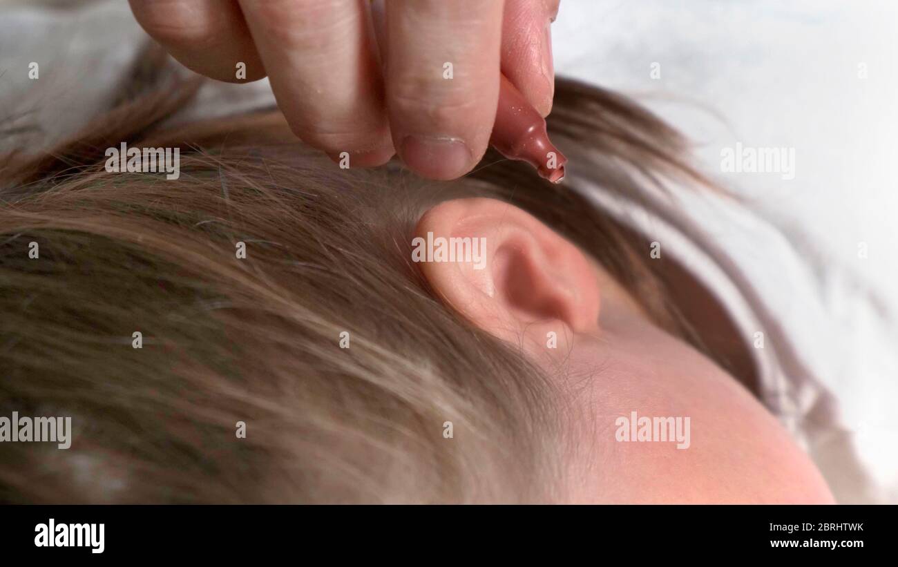 Close up male hand drips medicine into the ear of a sick child. Stock Photo