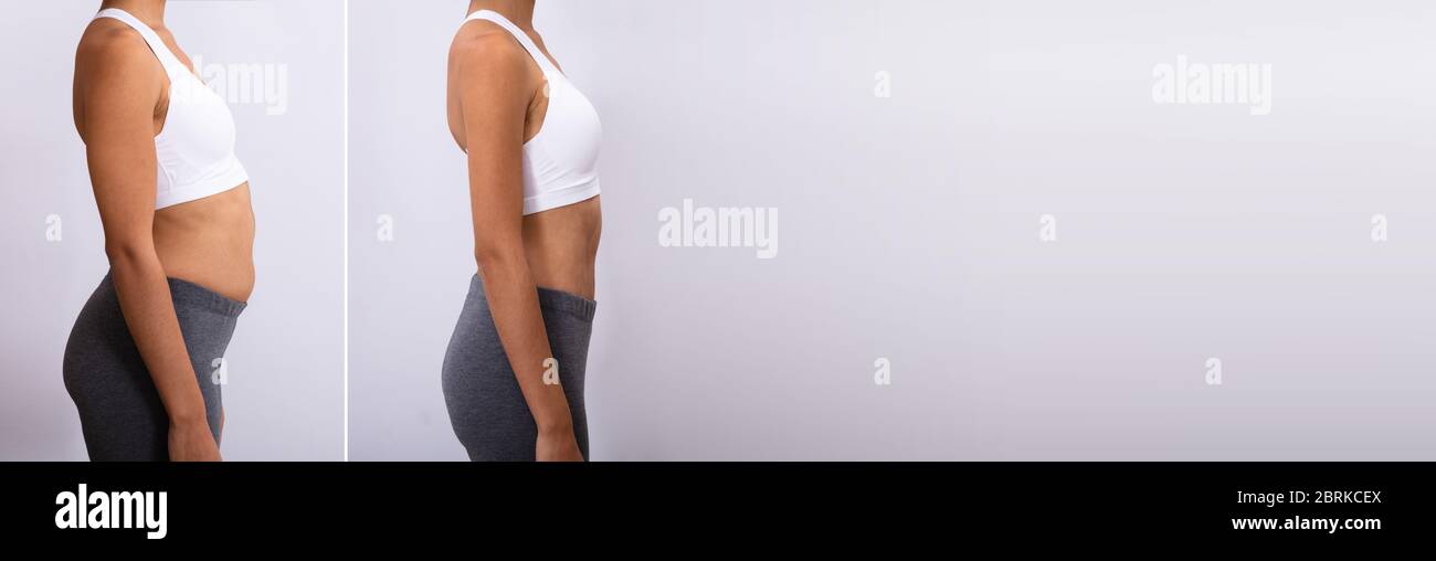 Before After Weight Loss. African American Woman Diet Stock Photo Alamy