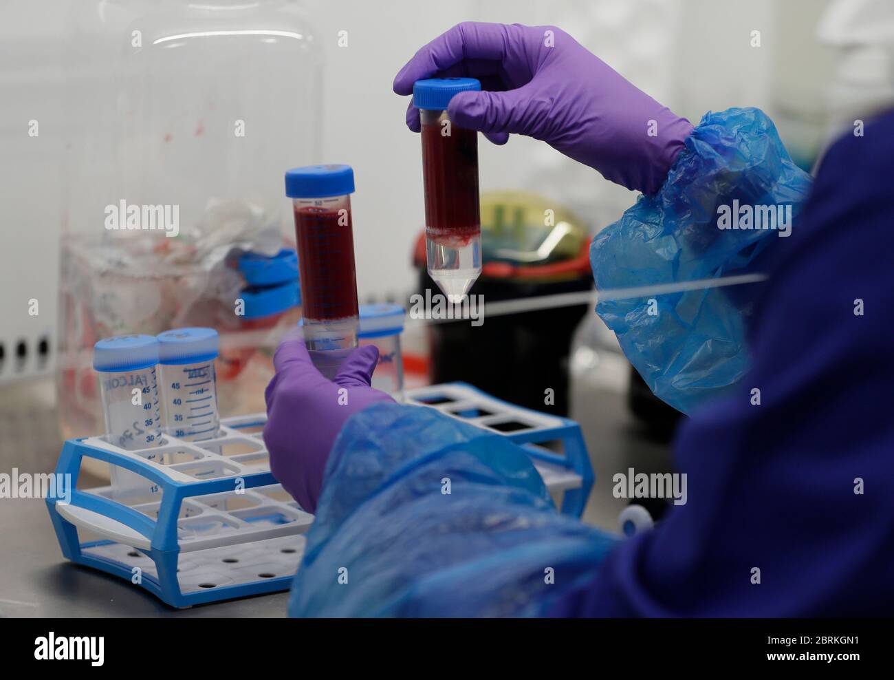 Blood samples from coronavirus patients are prepared for analysis as part of the TACTIC-R trial, in the Blood Processing Lab in the Cambridge Institute of Therapeutic Immunology and Infectious Disease, in Cambridge. Stock Photo