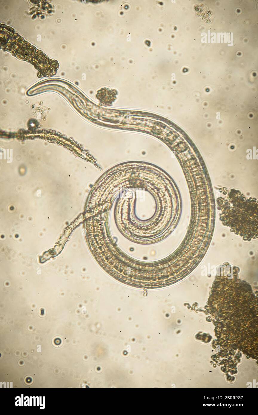 Trichinella spiralis - parasitic nematoda worm microscope Stock Photo -  Alamy