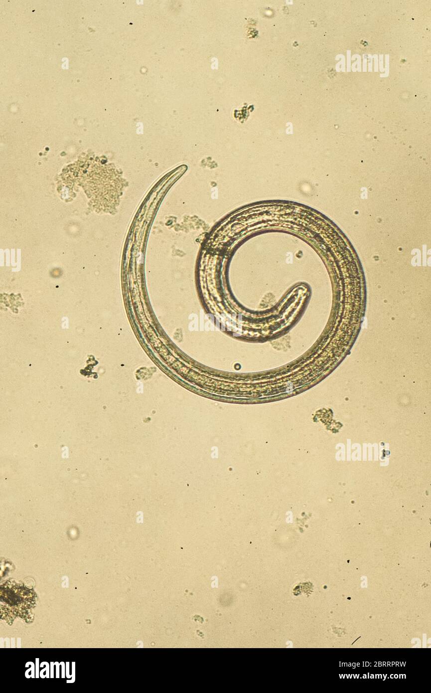 Trichinella spiralis - parasitic nematoda worm microscope Stock Photo