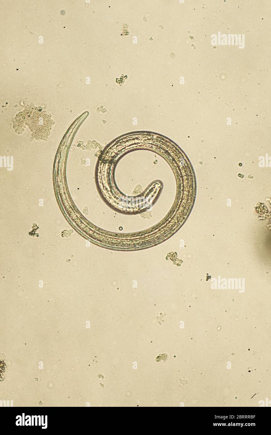 Trichinella spiralis - parasitic nematoda worm microscope Stock Photo