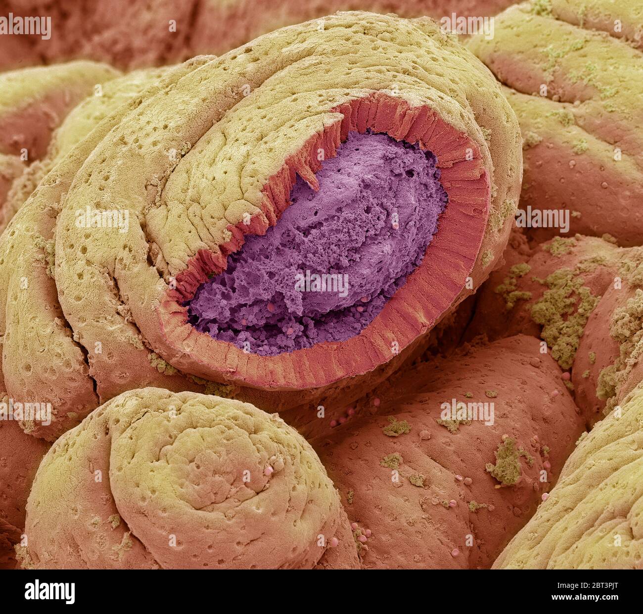Intestinal lining. Coloured scanning electron micrograph (SEM) of a ...