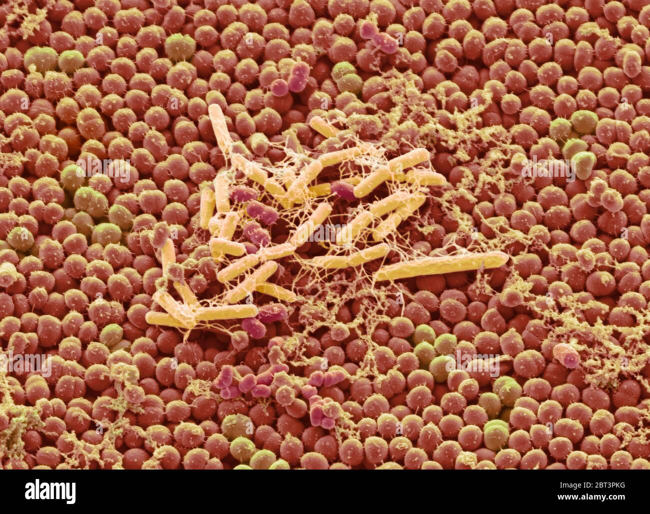 Bacteria from a human beard. Coloured scanning electron micrograph (SEM) of bacteria cultured from a human beard. A European study has found that the average man's beard is more replete with human-pathogenic bacteria than the dirtiest part of a dog's fur. There are around 1000 species of bacteria from 19 phyla found on human skin. Skin flora is usually non-pathogenic, and either commensal (not harmful to their host) or mutualistic (offer a benefit). Magnification: x4000 when printed at 10cm wide. Stock Photo