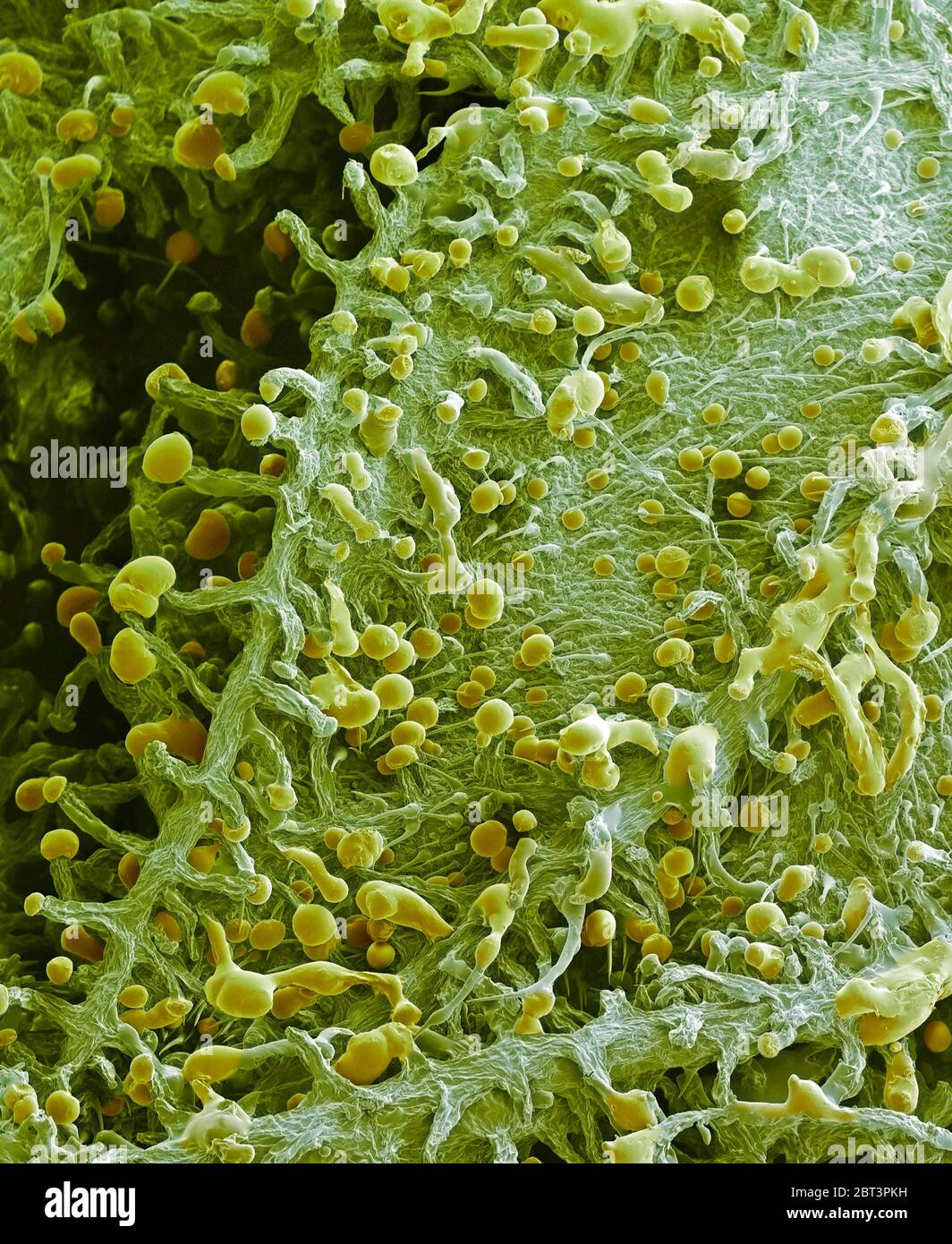 Cannabis plant. Coloured scanning electron micrograph (SEM) of the surface of a cannabis (Cannabis sativa) plant. The pointed hairs are called lithocyst cells. They contain cystoliths (calcium carbonate crystals). Glandular cells called trichomes are also present. These are capitate trichomes that have stalks. These trichomes secrete a resin (yellow) containing tetrahydrocannabinol, the active component of cannabis when used as a drug. Magnification: 220X when printed 10 cm wide. Stock Photo
