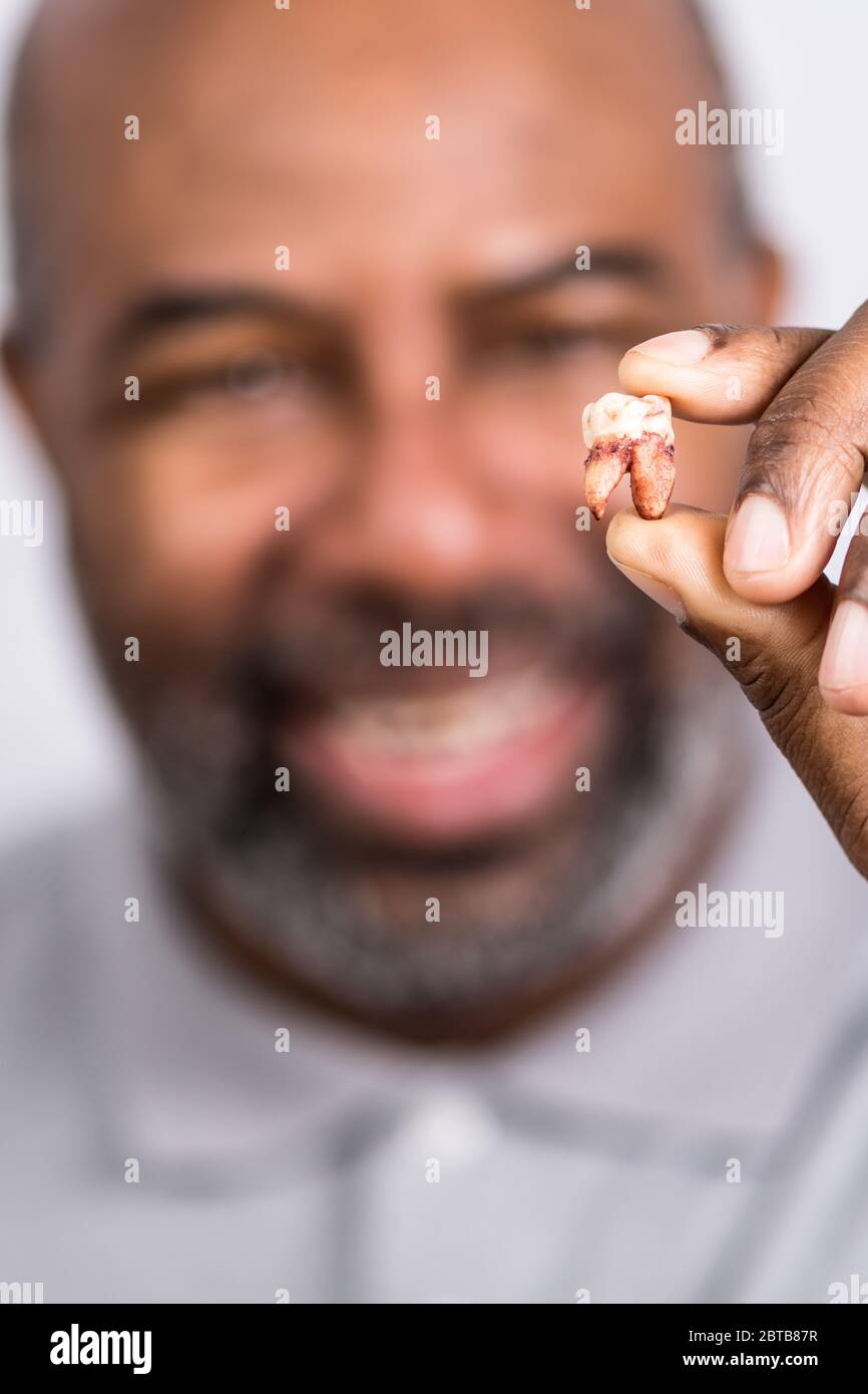 African American Man showing extracted tooth. Senior man happily holding pulled tooth.  Selected Focus with Blurred background. Stock Photo