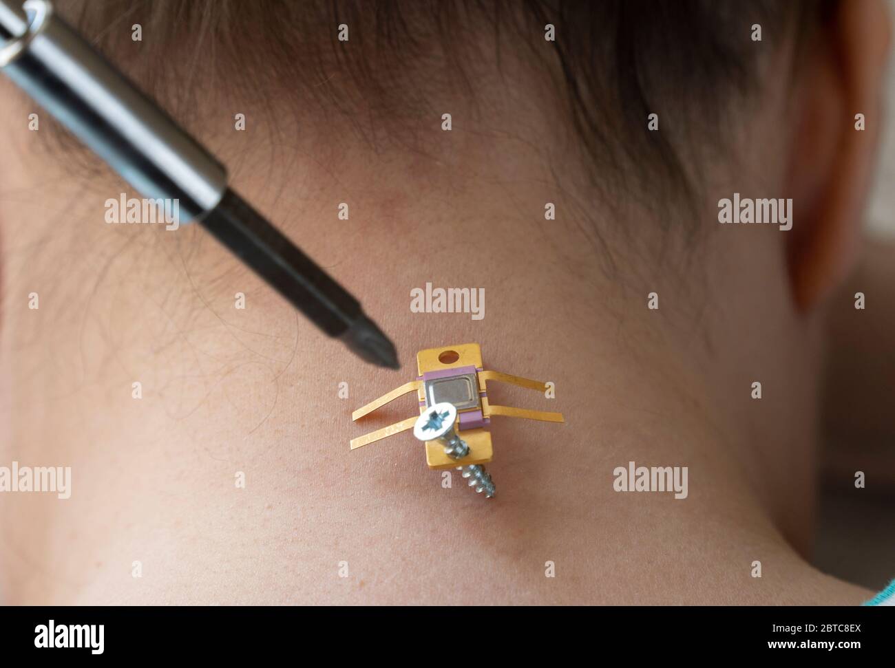 implantation of chip under the human skin. microchip is connected to