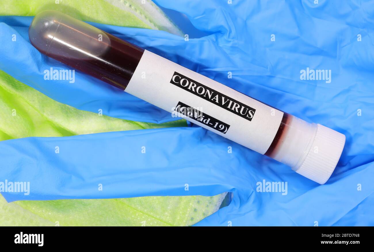 blood sample to carry out the serological test for the detection of ...