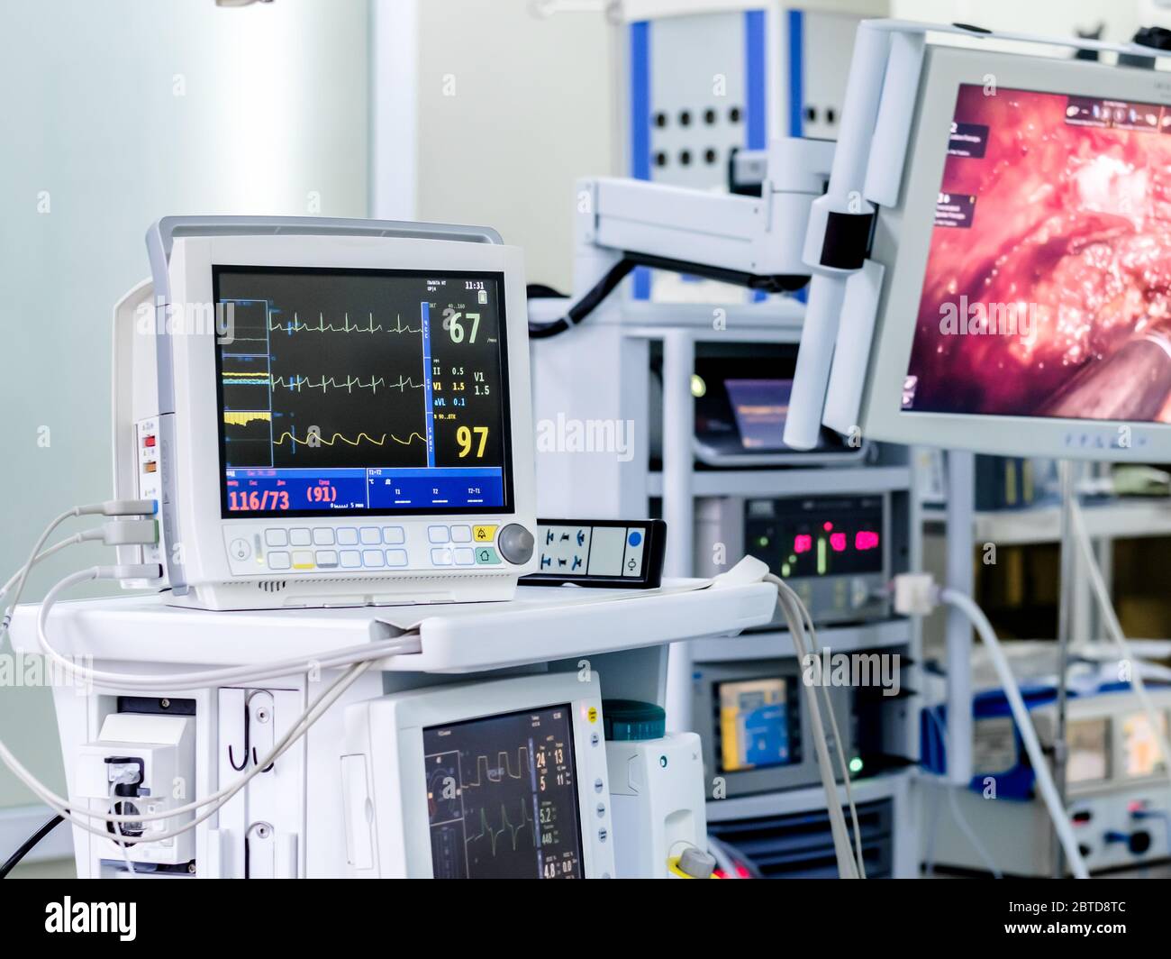Monitoring the patient vital functions during surgery. High-tech ...