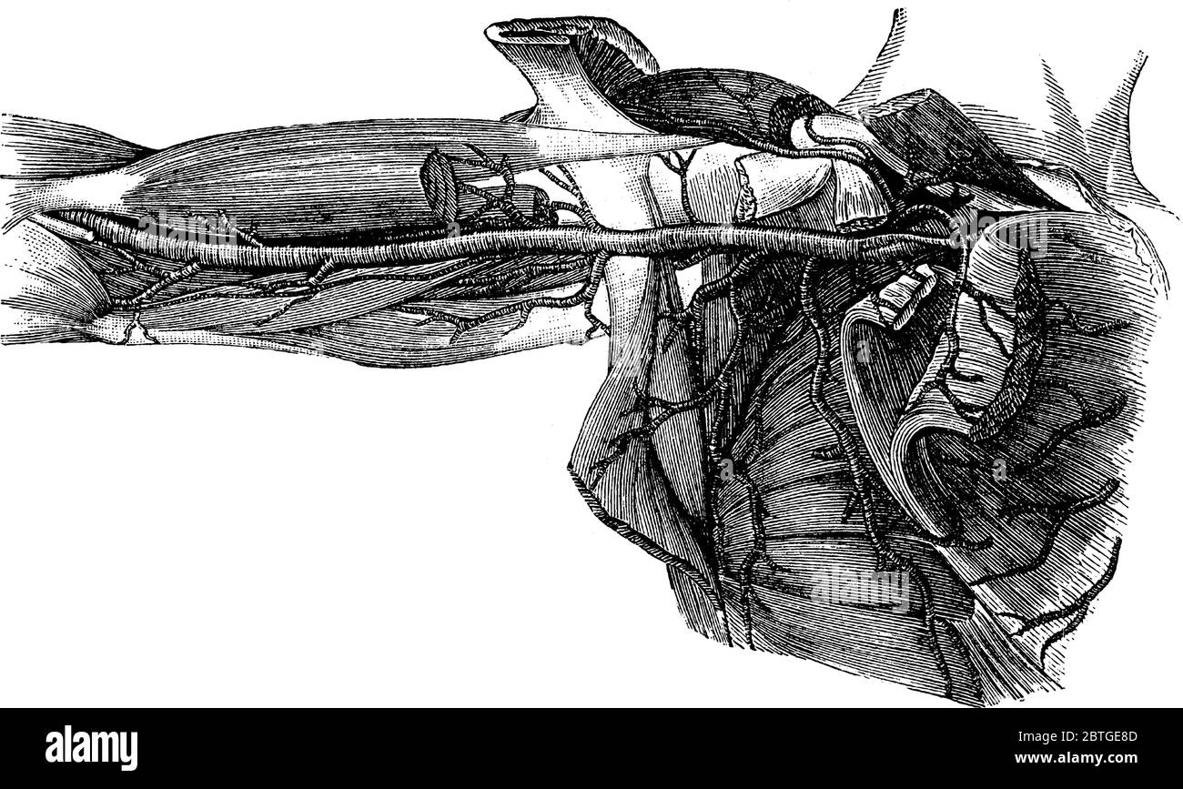 An artery is a vessel that carries blood away from the heart and toward