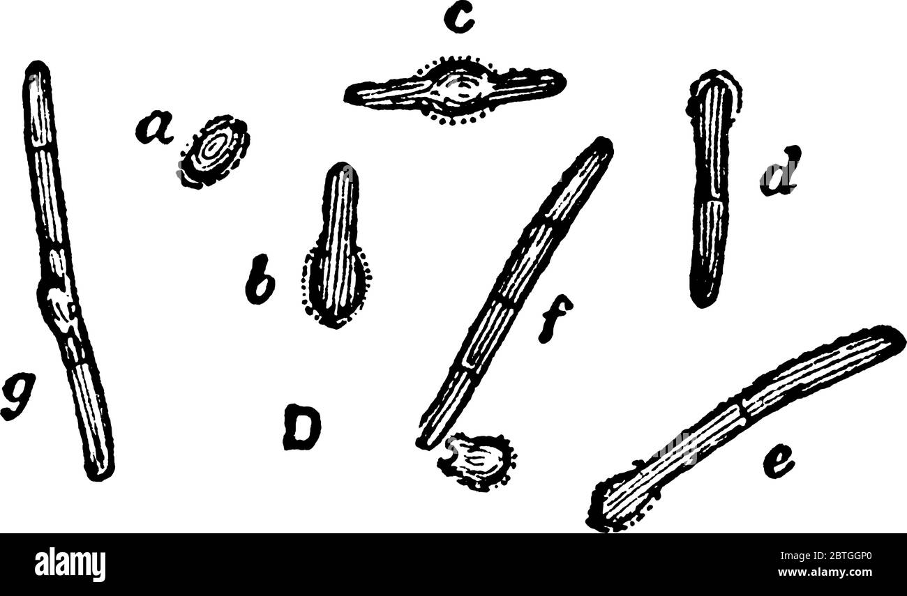 A typical representation of the various phases of germination of spores of Bacillus ramosus, as observed in hanging drops under high powers, vintage l Stock Vector