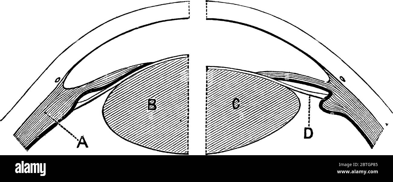 On the right the lens is arranged for distant vision, the ciliary muscle is relaxed, and the ligament, 'D' is tense, so flattening by its compression Stock Vector
