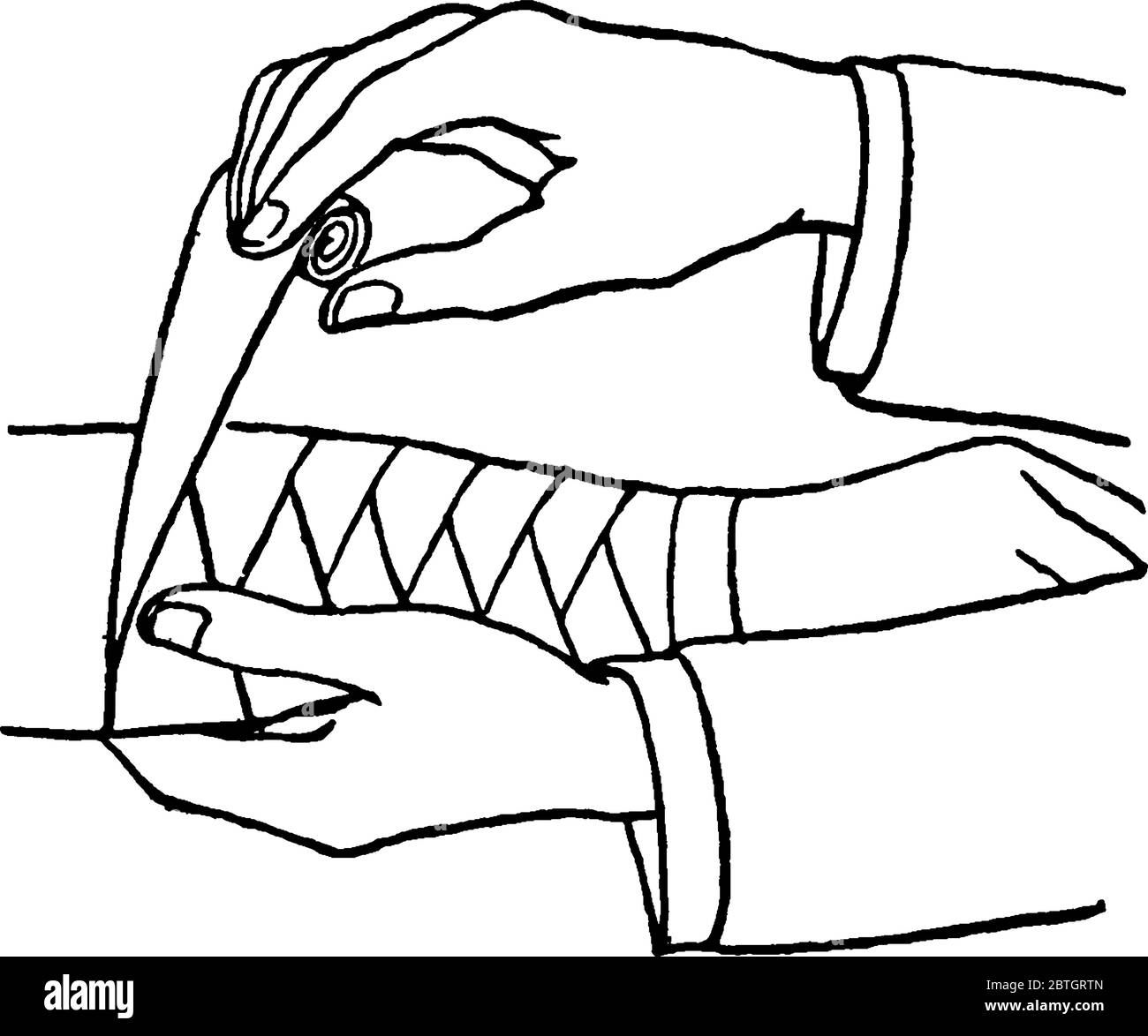 Two hands binding a bandage on an arm with , vintage line drawing or  engraving illustration Stock Vector Image & Art - Alamy