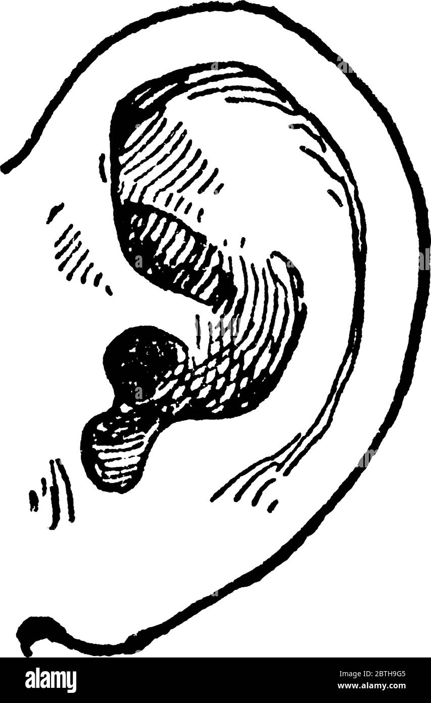 Schematic representation of the human ear. (Figs. 1 and 2 are after M.... |  Download Scientific Diagram