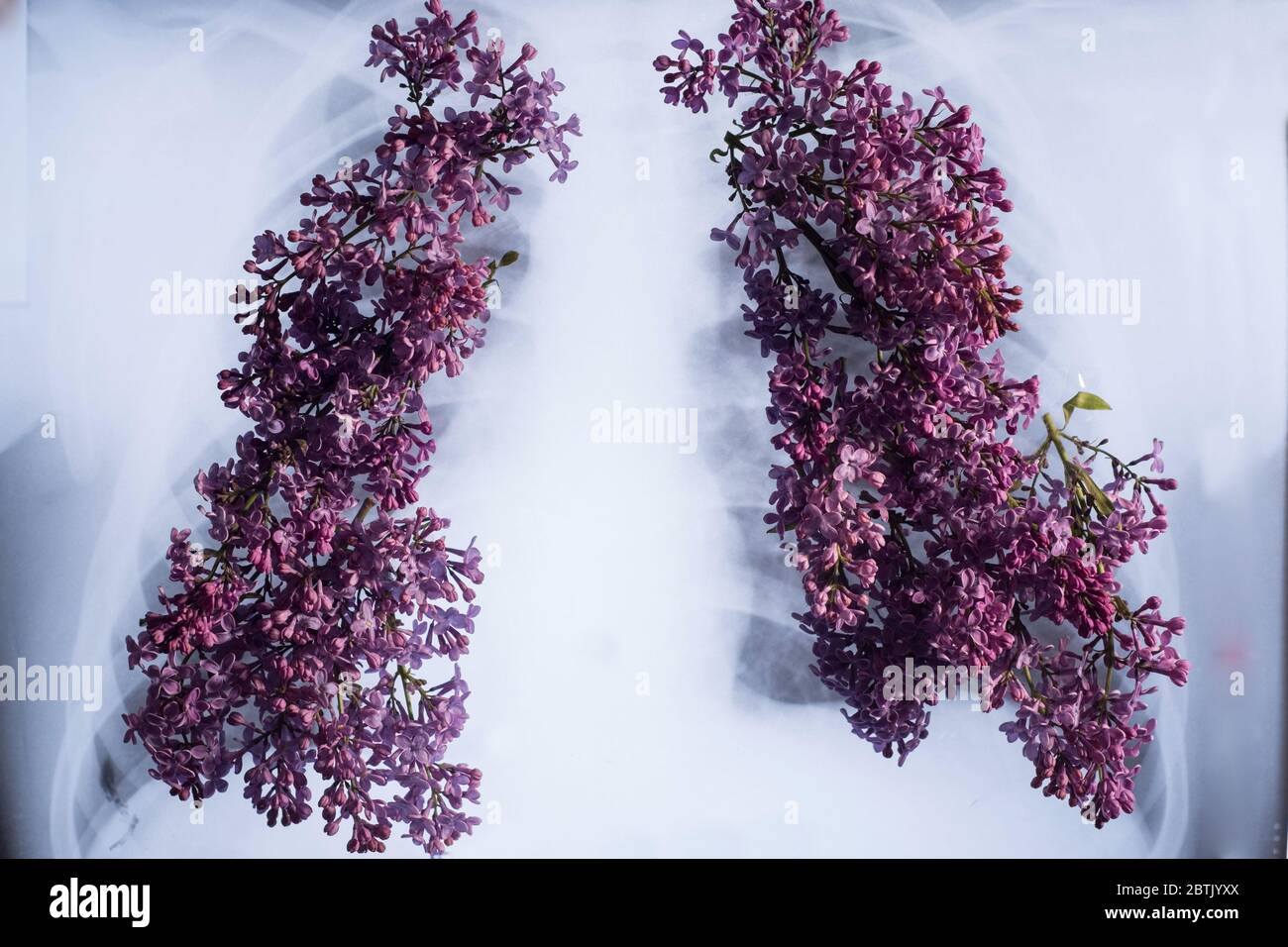 an xray of the lungs from which lilac flowers grow. Medical concept of