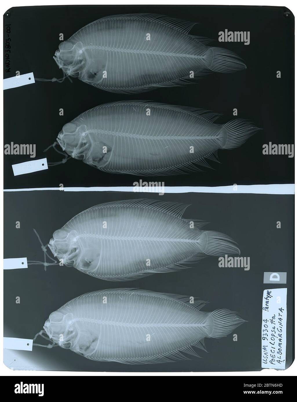 Poecilopsetta albomarginata Reid. Radiograph is of a paratype; The Smithsonian NMNH Division of Fishes uses the convention of maintaining the original species name for type specimens designated at the time of description. The currently accepted name for this species is Poecilopsetta inermis.25 Oct 20181003 Stock Photo