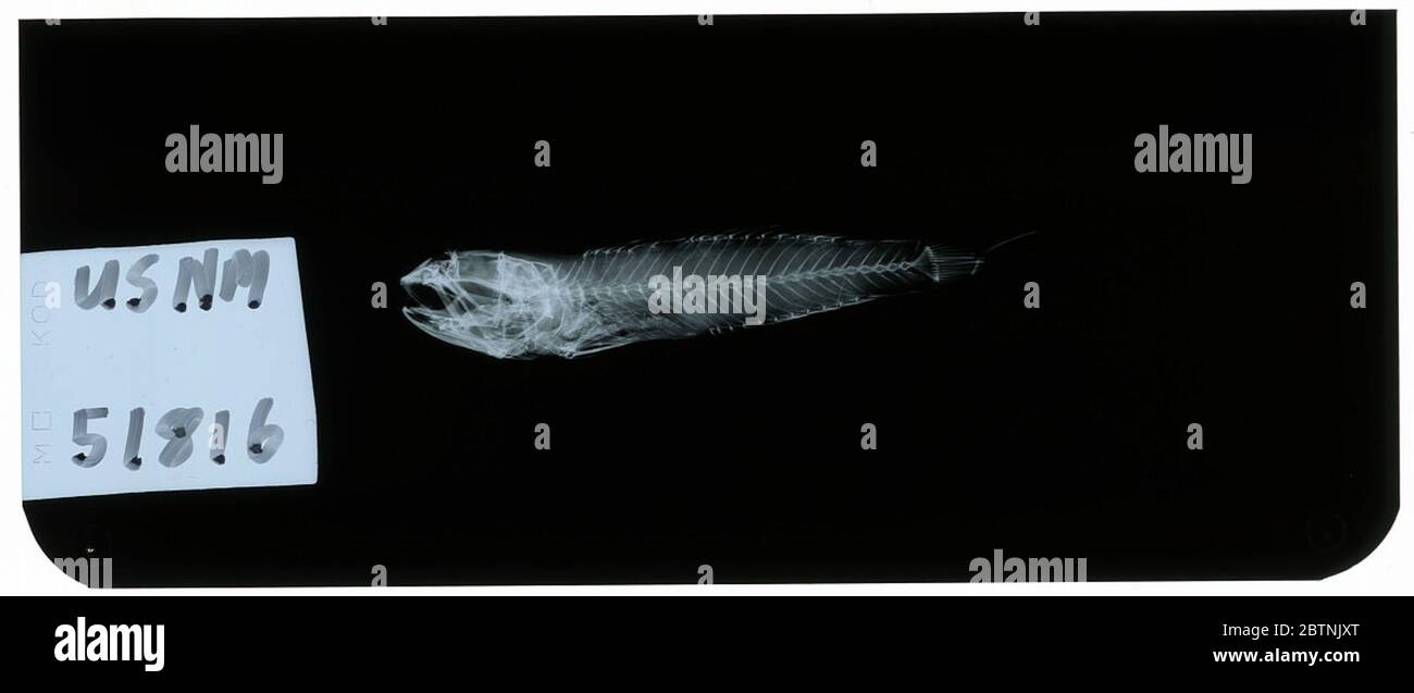 Waitea stomias. Radiograph is of a type; The Smithsonian NMNH Division of Fishes uses the convention of maintaining the original species name for type specimens designated at the time of description. Stock Photo