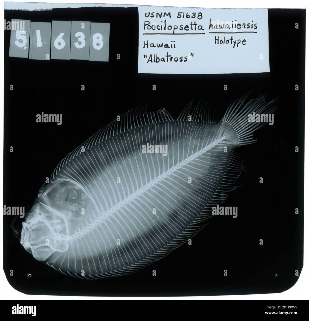 Poecilopsetta hawaiiensis Gilbert. Radiograph is of a type specimen.25 Oct 2018D. 38102 Stock Photo