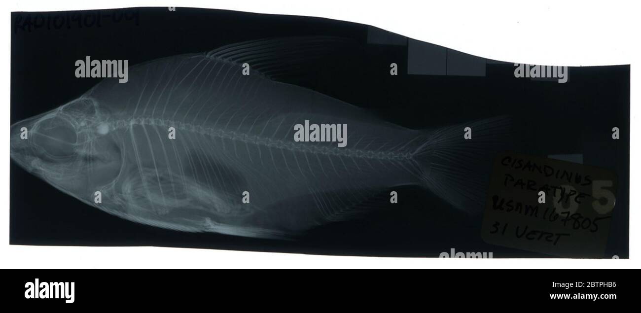 Psectrogaster cisandinus Allen. Radiograph is of a paratype; The Smithsonian NMNH Division of Fishes uses the convention of maintaining the original species name for type specimens designated at the time of description. The currently accepted name for this species is Curimata cisandina.25 Oct 20181 Stock Photo