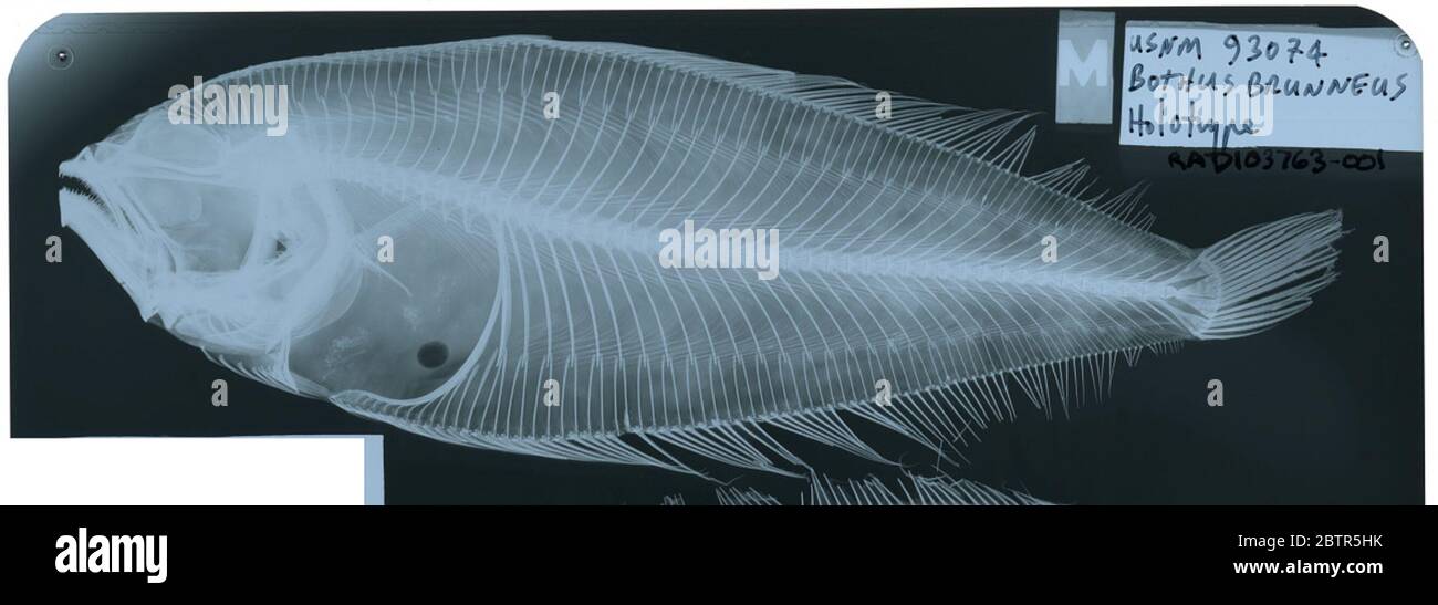 Bothus brunneus. Radiograph is of a type; The Smithsonian NMNH Division of Fishes uses the convention of maintaining the original species name for type specimens designated at the time of description. The currently accepted name for this species is Arnoglossus brunneus.29 Oct 2018D 54532 Stock Photo