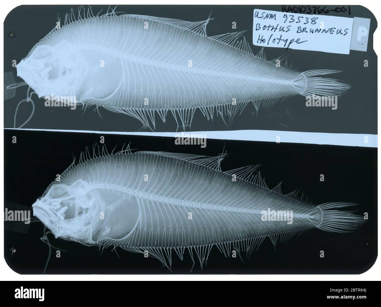 Bothus brunneus. Radiograph is of a paratype; The Smithsonian NMNH Division of Fishes uses the convention of maintaining the original species name for type specimens designated at the time of description. The currently accepted name for this species is Arnoglossus brunneus.29 Oct 2018D 54541 Stock Photo