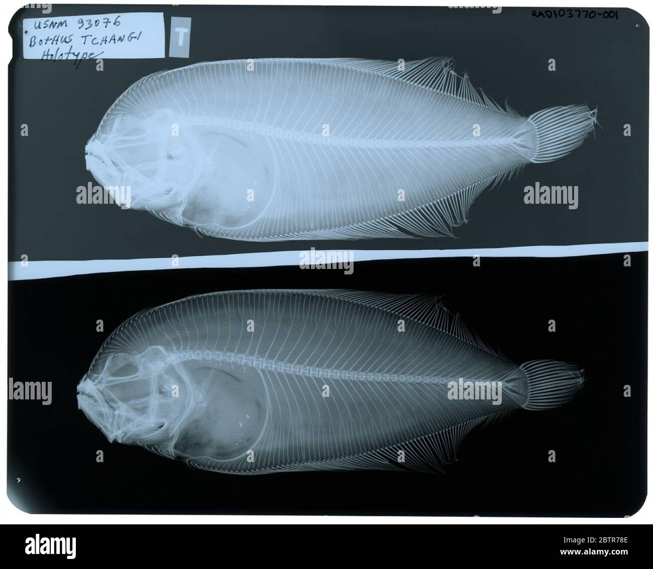 Bothus tchangi. Radiograph is of a type; The Smithsonian NMNH Division of Fishes uses the convention of maintaining the original species name for type specimens designated at the time of description. The currently accepted name for this species is Arnoglossus polyspilus.29 Oct 2018D. 54751 Stock Photo