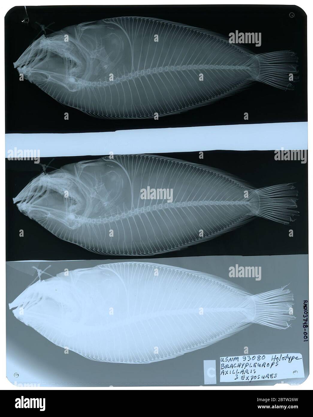 Brachypleurops axillaris Fowler. Radiograph is of a holotype; The Smithsonian NMNH Division of Fishes uses the convention of maintaining the original species name for type specimens designated at the time of description. The currently accepted name for this species is Citharoides macrolepidotus.25 Oct 2018D. Stock Photo