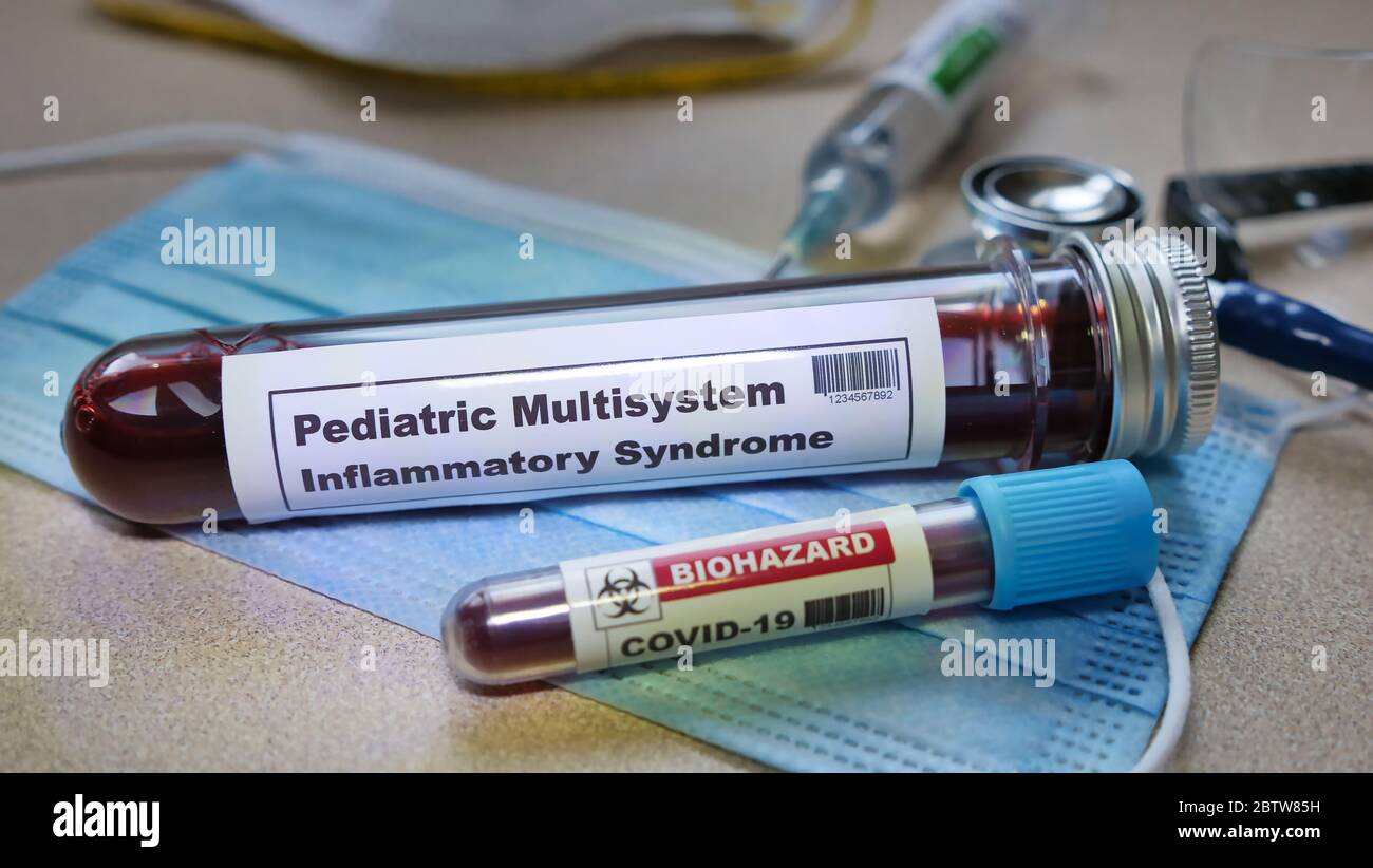 Pediatric multisystem inflammatory syndrome kawasaki disease symptoms