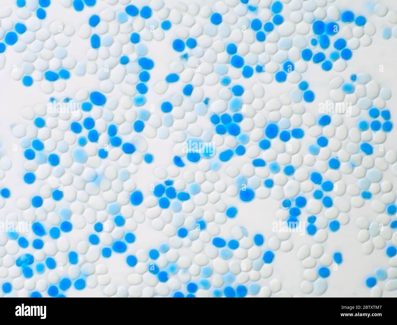 Mold spores, stained with lactophenol cotton blue, micrograph width is approximately 121 micrometer Stock Photo