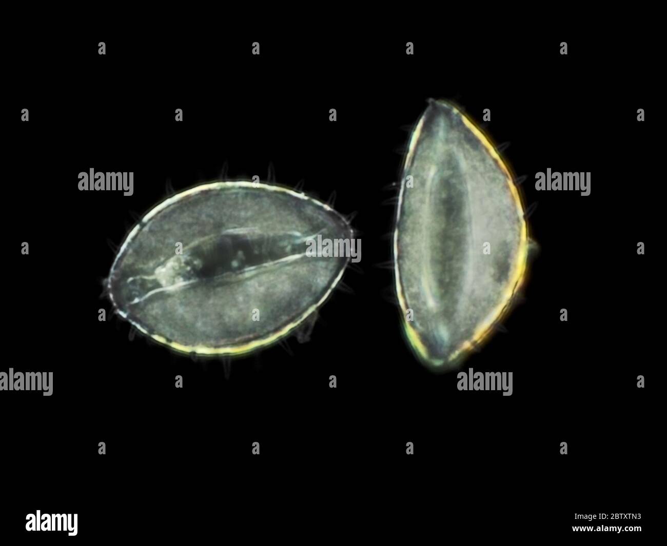 Dark field light micrograph of yellow pond lily (Nuphar polysepala) pollen grains, pictured area is about 160 micrometers wide Stock Photo