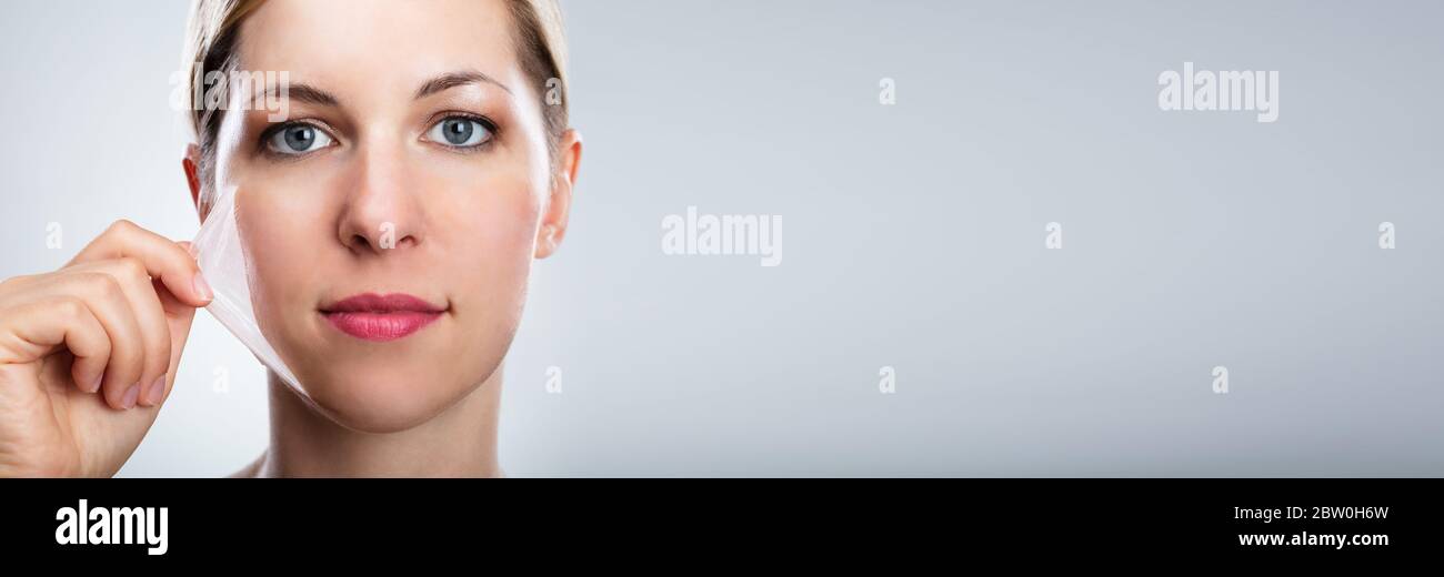 facial skin peeling treatment near me