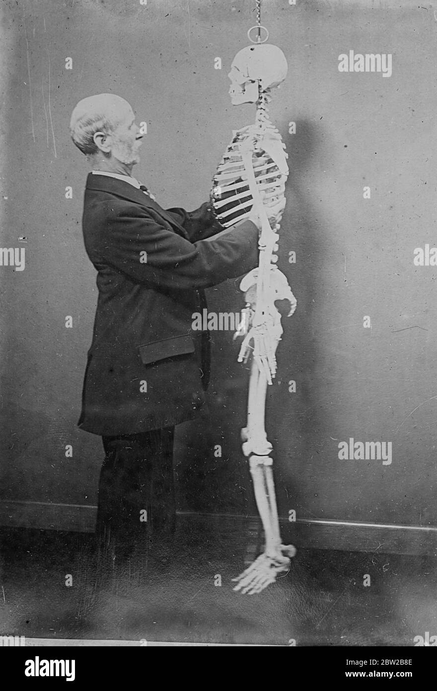Checking the skeletal bones are aligned. undated Stock Photo