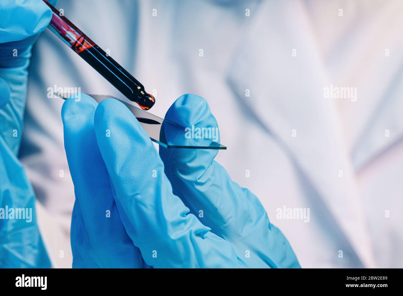 Hand Doing Lab Hands laboratory technician holding blood hi-res stock photography and ...