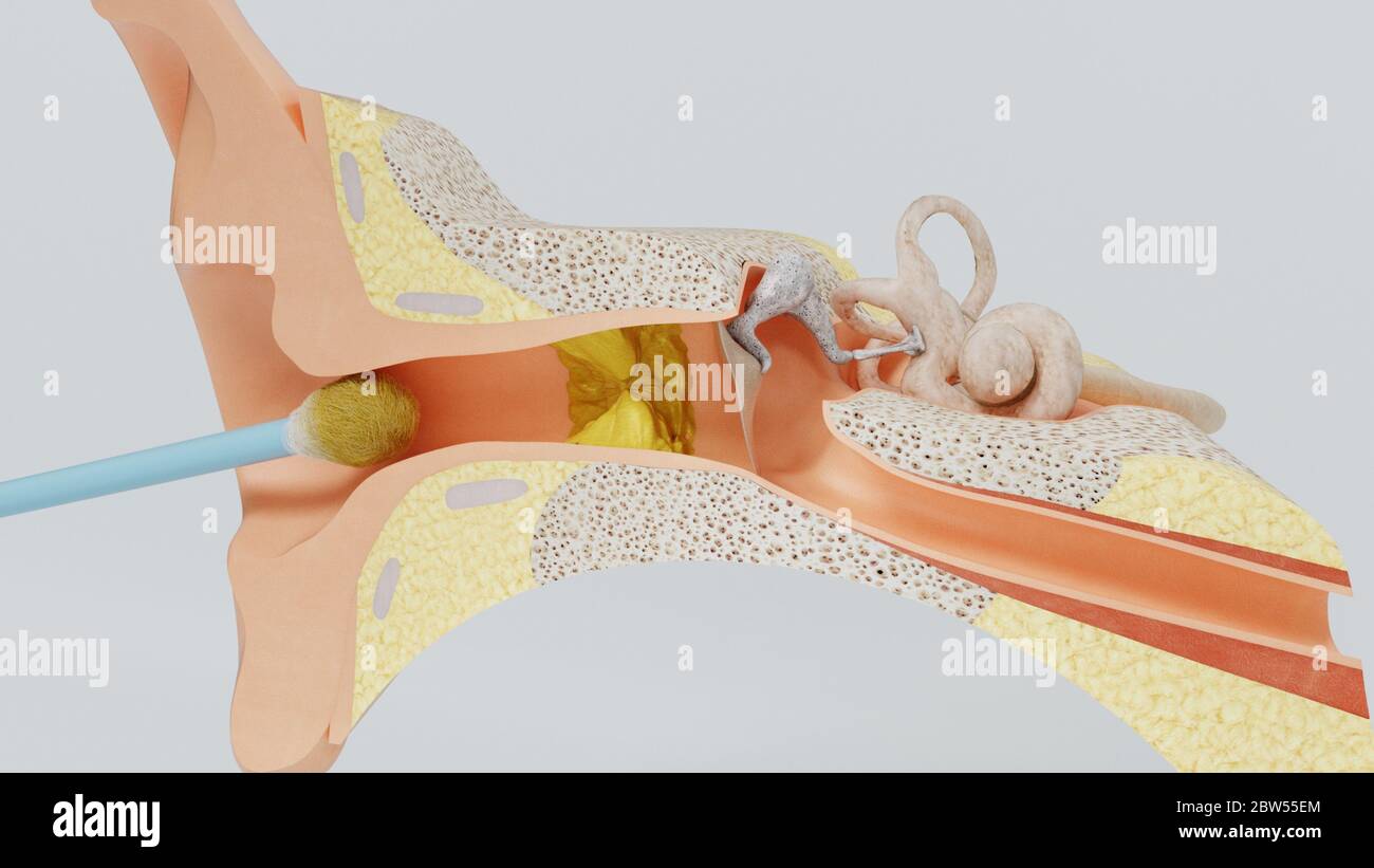 Cochlear shell hi-res stock photography and images - Alamy