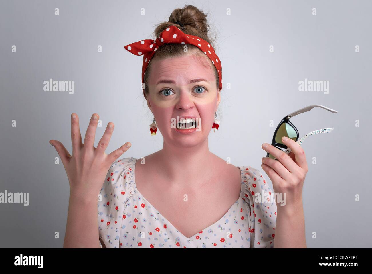 Young caucasian woman girl with red sunglasses sunburn on her face. Stock Photo