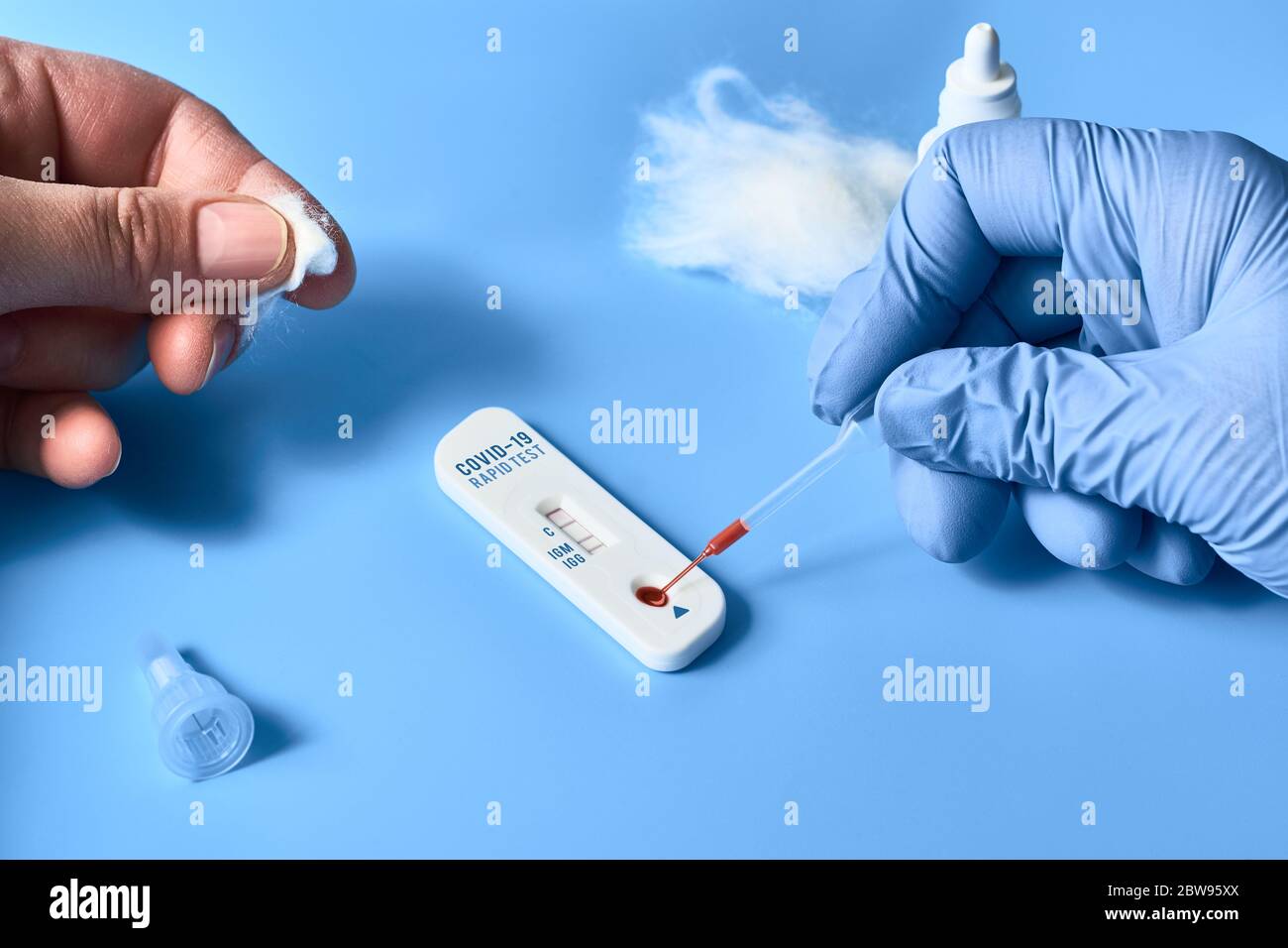 Express COVID-19 test for IgM and IgG antibodies to novel coronavirus ...