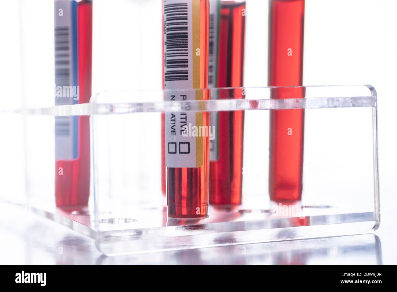 Studio shot of Covid-19 blood samples in test tube rack Stock Photo