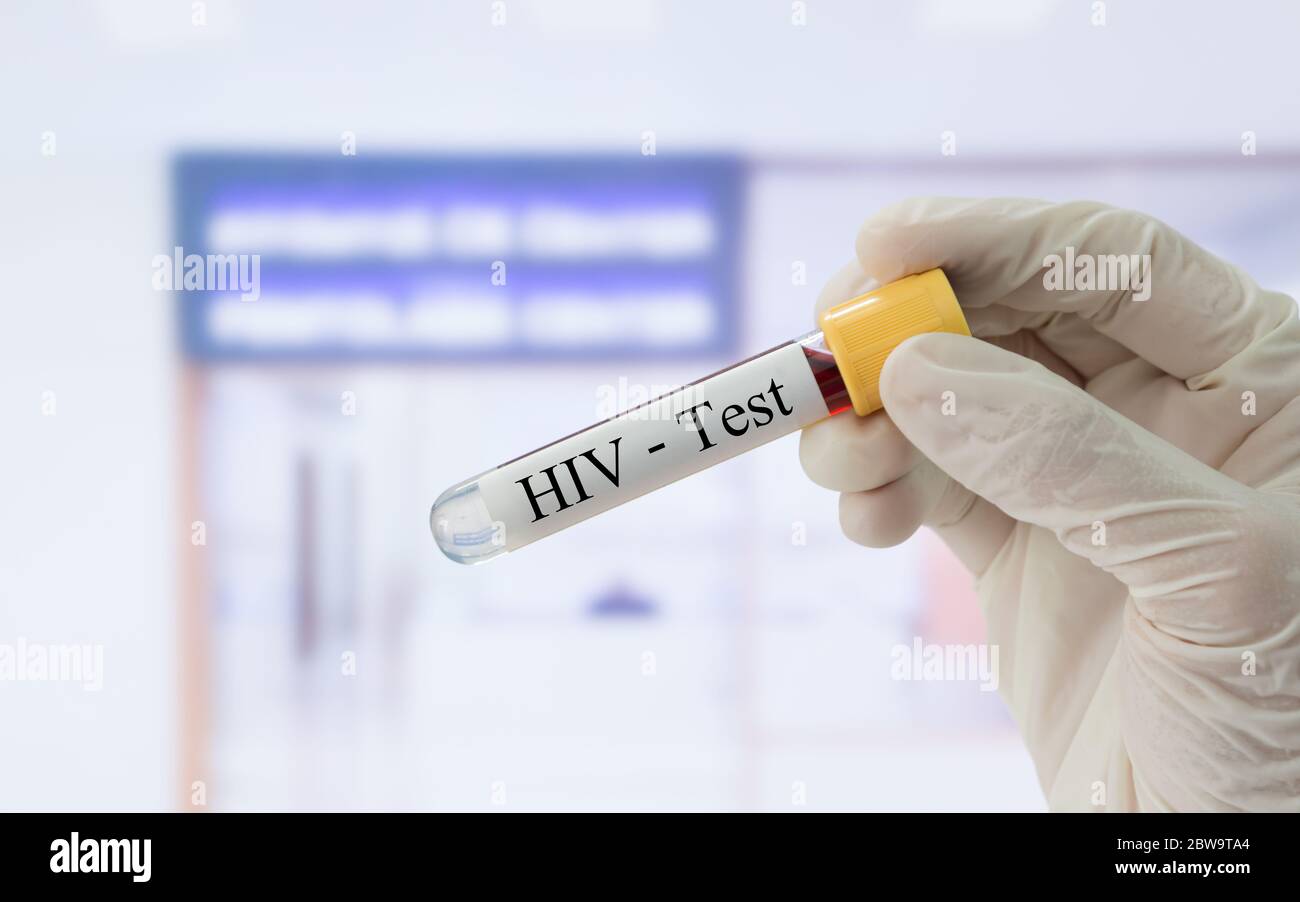 Doctor holding sample blood collection tube with HIV test label in front of the laboratory. Stock Photo