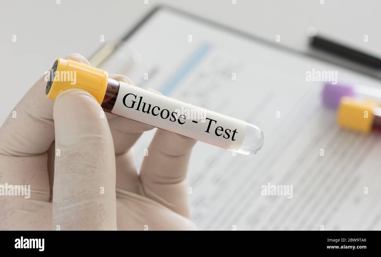 Doctor holding sample blood collection tube with glucose test label in the lab. Stock Photo