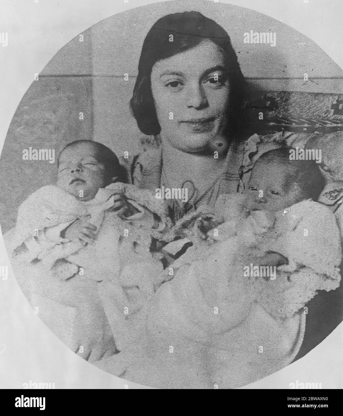 America 's  Siamese Twins  . Mrs Meyer Zarelzky , of New York City , with her twin girls who on November 22nd were born locked in bone and tissue in the region just below the neck . They were successfully separated and are now thriving . 10 January 1923 Stock Photo