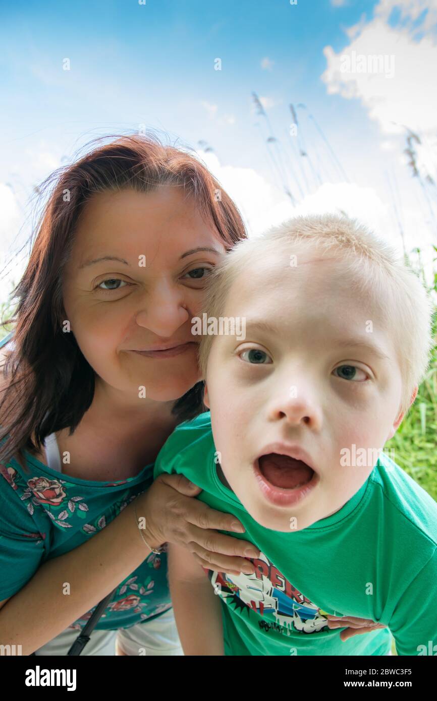 Defect,childcare,medicine and people concept happy mother and son with