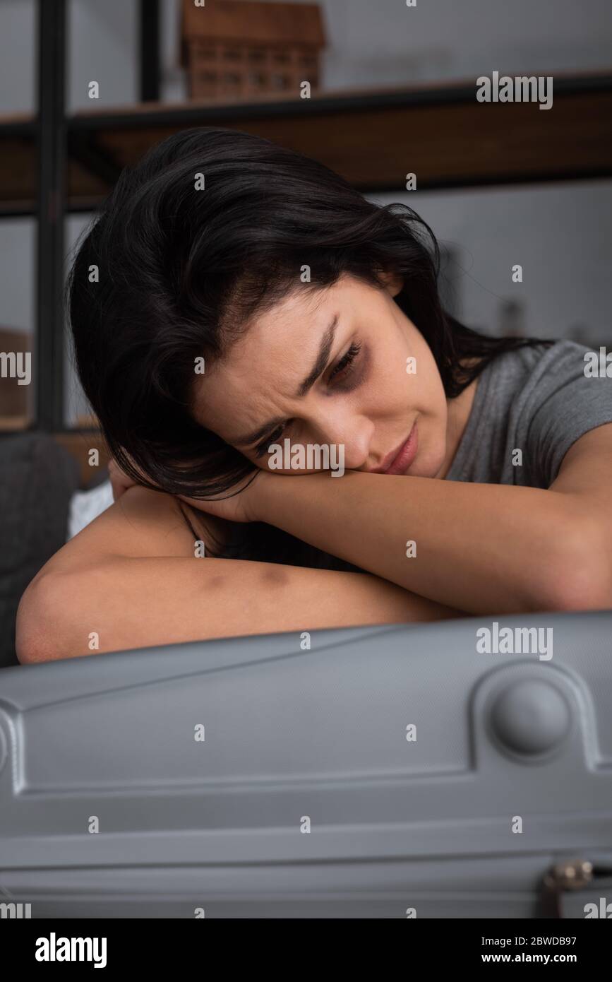 depressed woman with bruise on face crying near suitcase, domestic violence concept Stock Photo