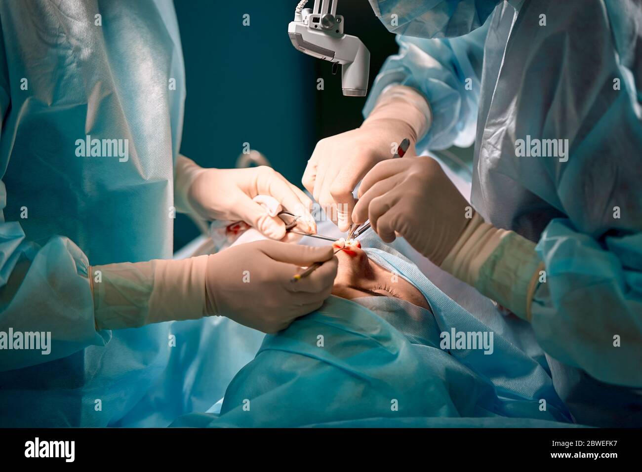 Rhinoplasty, closeup, nose reconstruction after an accident. Beauty