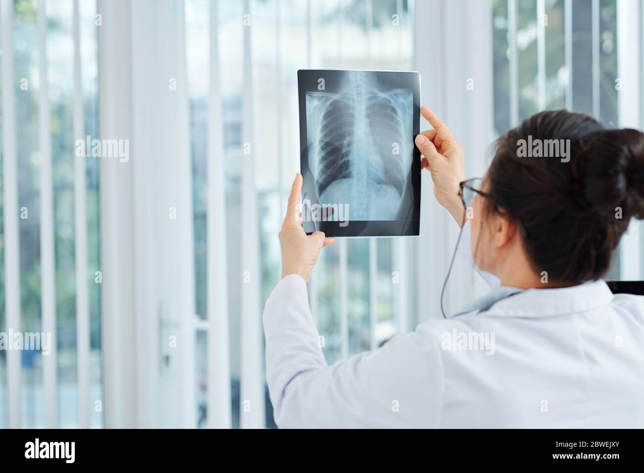 Doctor checking lungs x-ray of patient with lung inflammation indicating the presence of pneumonia Stock Photo