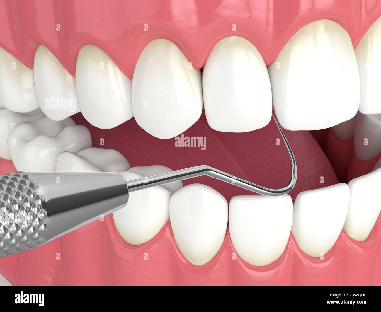 3d render of jaw with dental explorer. Dental diagnostic tools concept